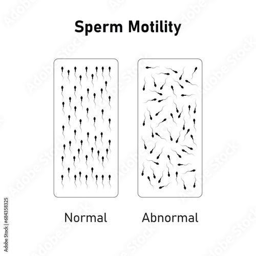 Sperm Motility Scientific Design. Vector Illustration.