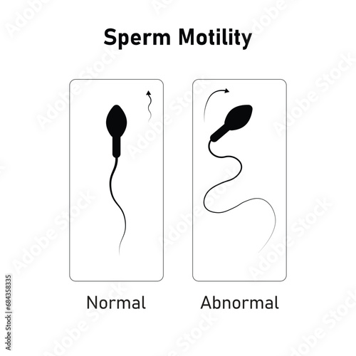 Sperm Motility Scientific Design. Vector Illustration.