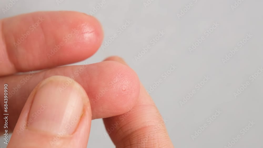 Close up view on woman using lancet on finger for checking blood sugar level by Glucose meter. Healthcare and Medical treatment, Diabetes and low or high glycemia concept.