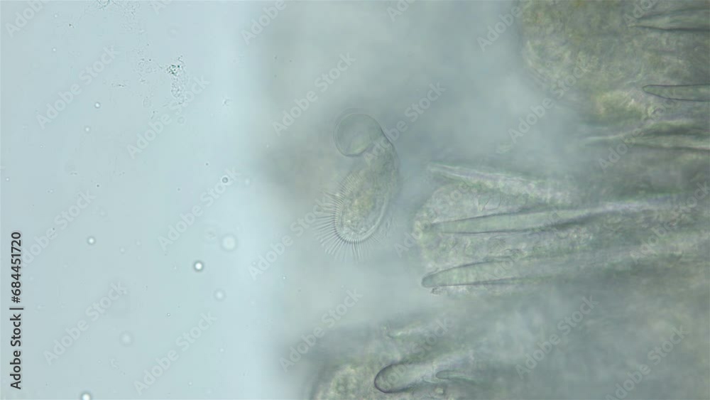 Ciliophora Licnophora sp. under microscope, class Spirotrichea. Found on the body of the mollusk genus Onchidoris. The name means fan-bearer . White sea Ciliophora Licnophora sp. under microscope, class Spirotrichea. Found on the body of the mollusk genus Onchidoris. The name means fan-bearer . White sea