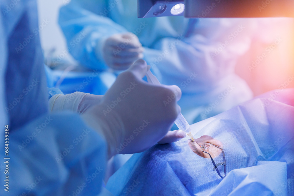 Process laser vision correction, lasik treatment. Doctor use equipment for fixing eyeball, patient under sterile cover Process laser vision correction, lasik treatment. Doctor use equipment for fixing eyeball, patient under sterile cover