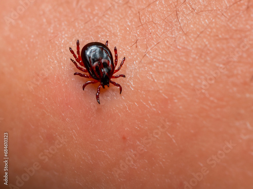 red tick on the human arm.