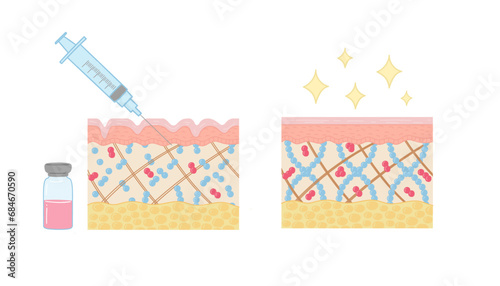 mesotherapy for skin. anatomical illustration in cartoon style