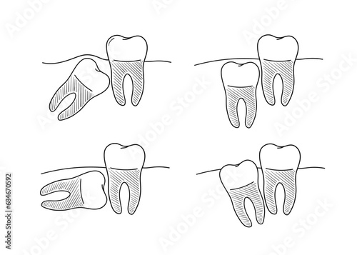 Dental anatomy set, incorrect teeth growth, set of vector illustrations in doodle style