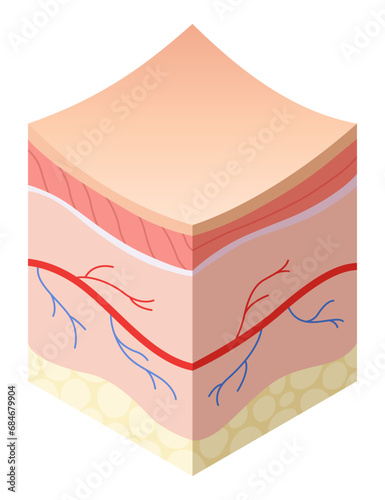 Skincare medical concept. Problems in cross-section of human skin horizontal layers structure. Anatomy illustrative model healthly layers of skin
