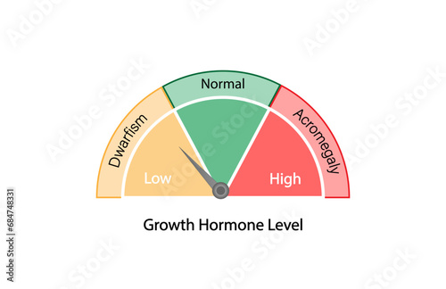 Growth hormone level. Somatotropin. Dwarfism and Acromegaly. Vector illustration.  
