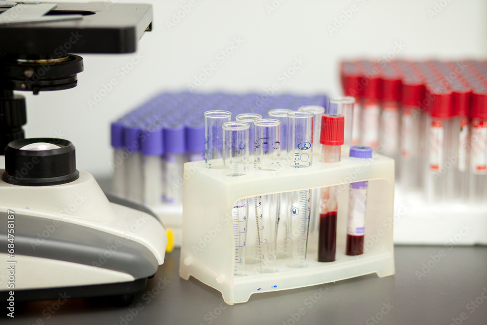 medical test tubes stand on the table with blood tests medical test tubes stand on the table with blood tests