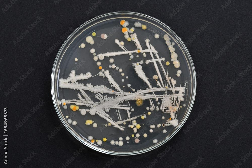 bacteria-microbiology-bacterial-colony-morphology-bacterial-growth