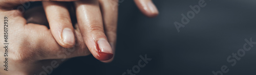 woman bloody finger