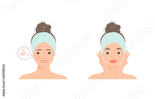 Sad cartoon woman with dry skin problem compare with Happy  woman with normal skin. Skin care procedure concept person. Vector design illustrations.
