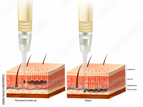Difference between tattoo and permanent make-up process. Pigment under layers skin of Epidermis, Dermis and Gipodermis.