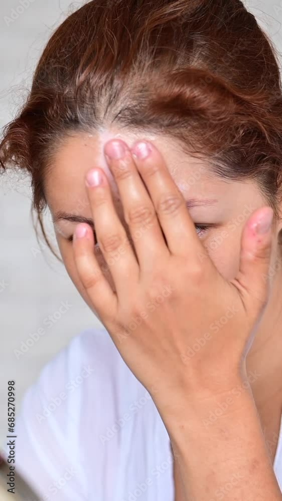 Portrait of a Caucasian woman with vitiligo diseas uses sunscreen. Vertical video. Portrait of a Caucasian woman with vitiligo diseas uses sunscreen. Vertical video.