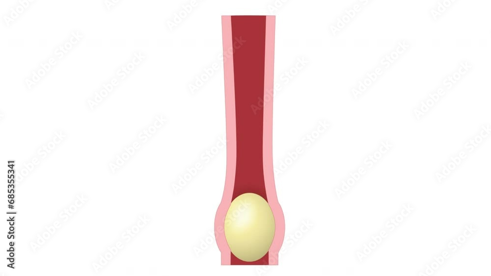 Peristalsis. Gastrointestinal motility. Smooth muscle contraction. 2d animation of peristaltic waves