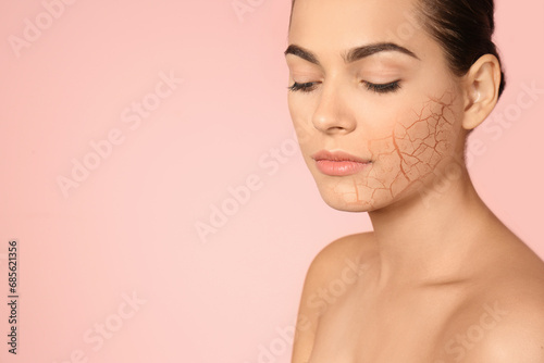 Beautiful young woman with dry skin on pink background. Space for text photo