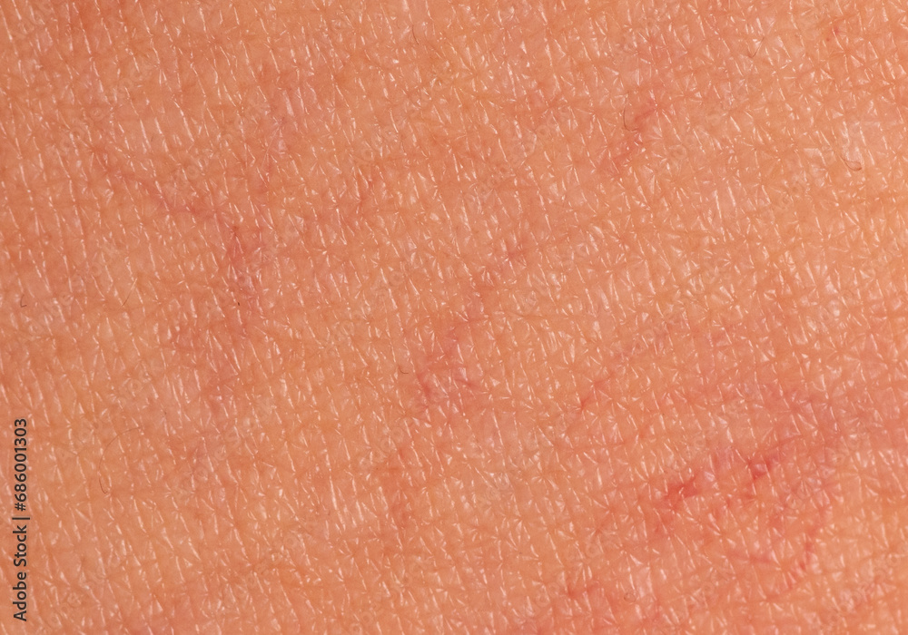 Close-up of veins on the skin. Macro Close-up of veins on the skin. Macro