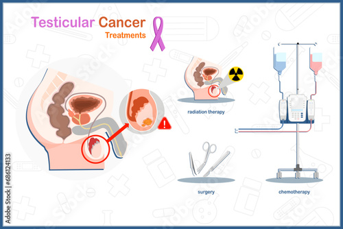 Testicular cancer treatment. Medical illustration vector concept in flat style of testicular cancer treatment includes surgery,chemotherapy and radiation therapy.