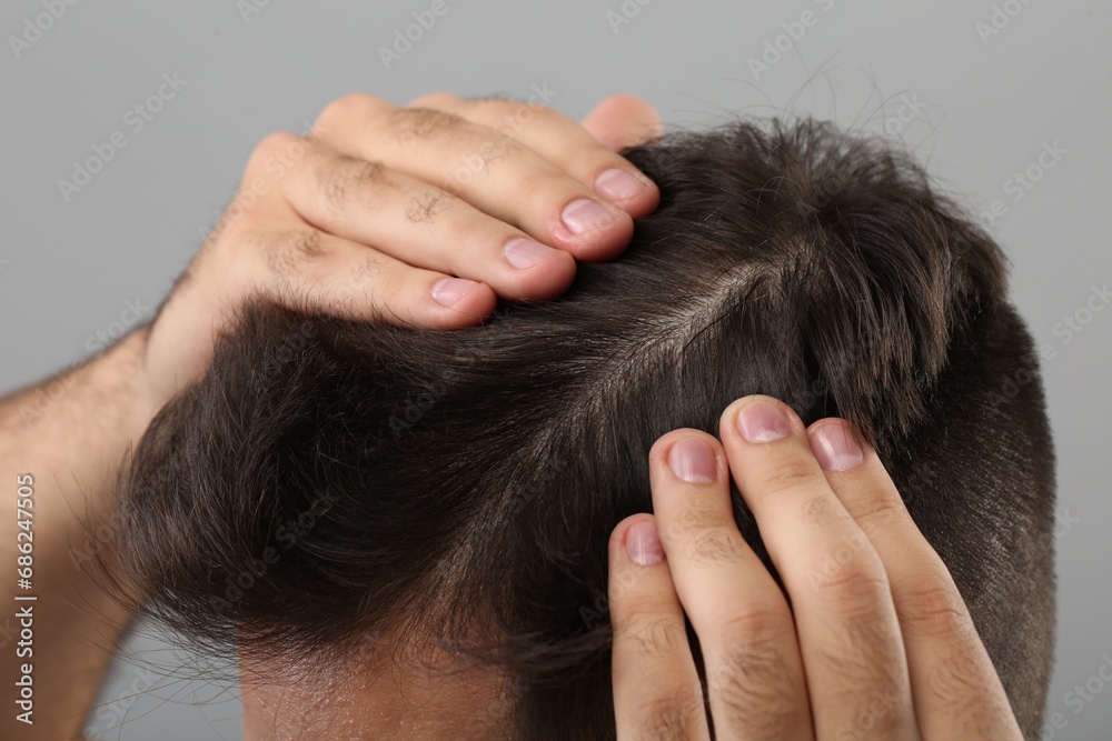 Fototapeta premium Man examining his head on light grey background, closeup. Dandruff problem
