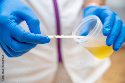 Close up of Nurse Hand holding urine sample container for medical urine analysis with color strip. High quality photo