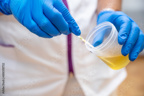 Close up of Nurse Hand holding urine sample container for medical urine analysis with color strip. High quality photo photo