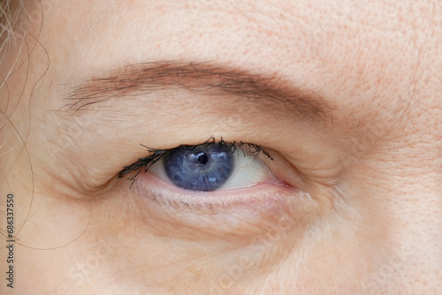 middle aged female's eye with drooping eyelid making eyebrow makeup. Ptosis is a drooping of the upper eyelid, lazy eye. Cosmetology and facial concept, first wrinkles