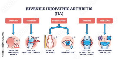 Juvenile idiopathic arthritis or JIA ad children disease outline diagram. Labeled educational scheme with medical condition for kids with joint pain, swelling and stiffness vector illustration. photo
