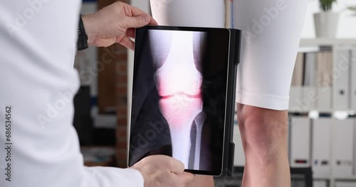 Doctor holding digital tablet with xray of knee near patient leg closeup 4k movie slow motion. X ray diagnostics of rheumatoid arthritis modern technologies concept photo