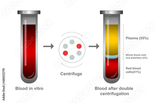 Glass medical test tube filled with blood in vitro and blood after double centrifugation, plasma and layers of red blood cells. Chemical glass in realistic style. Medical laboratory.