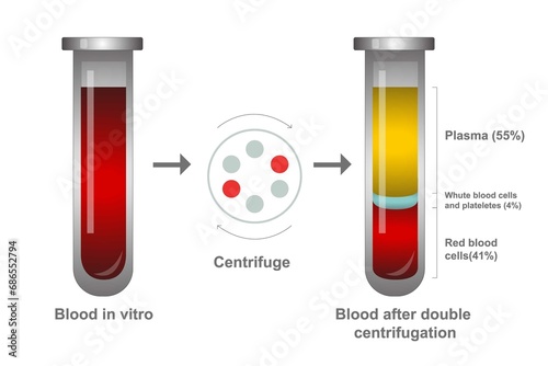 Glass medical test tube filled with blood in vitro and blood after double centrifugation, plasma and layers of red blood cells. Chemical glass in realistic style. Medical laboratory.