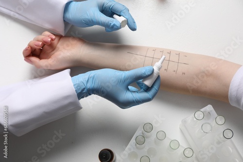 Doctor doing skin allergy test at light table, top view photo