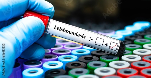 Blood sample of patient positive tested for leishmania. photo