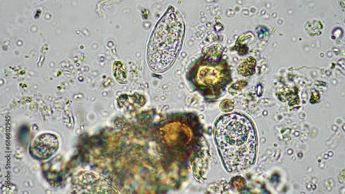 flagellates and amoeba protozoa soil microorganisms close up under the microscope. in a soil samlple from a farm photo