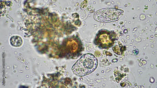 Microorganisms and biology in Compost and soil sample under the microscope in australia in a lab
 photo