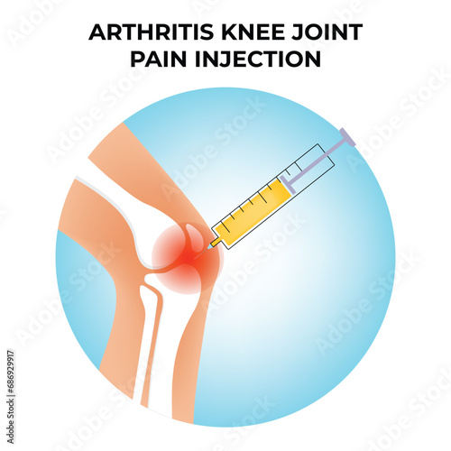 Arthritis Knee Joint Pain Injection Vector Design Illustration