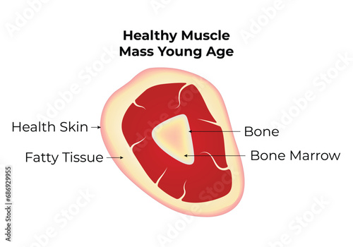 Muscle Loss in Sarcopenia Old Age Science Design Vector Illustration photo