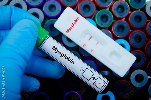 Blood sample of patient positive tested for myoglobin by rapid diagnostic test. photo