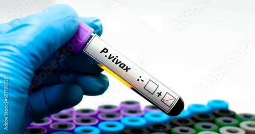 Blood sample of malaria patient positive tested for plasmodium vivax. photo