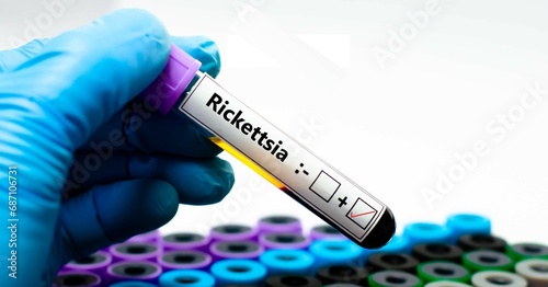 Blood sample of patient positive tested for rickettsia. photo