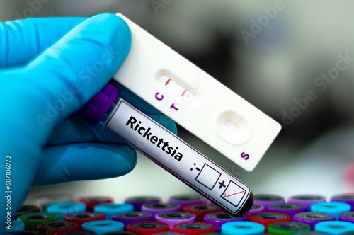 Blood sample of patient positive tested for rickettsia by rapid diagnostic test. photo