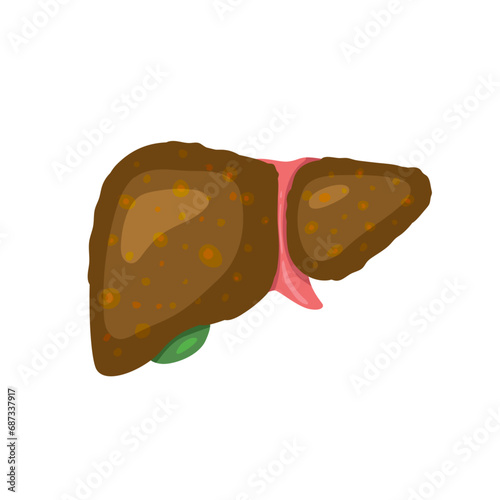 fibrosis liver damage digestive sickness disease healthcare medical hospital doctor