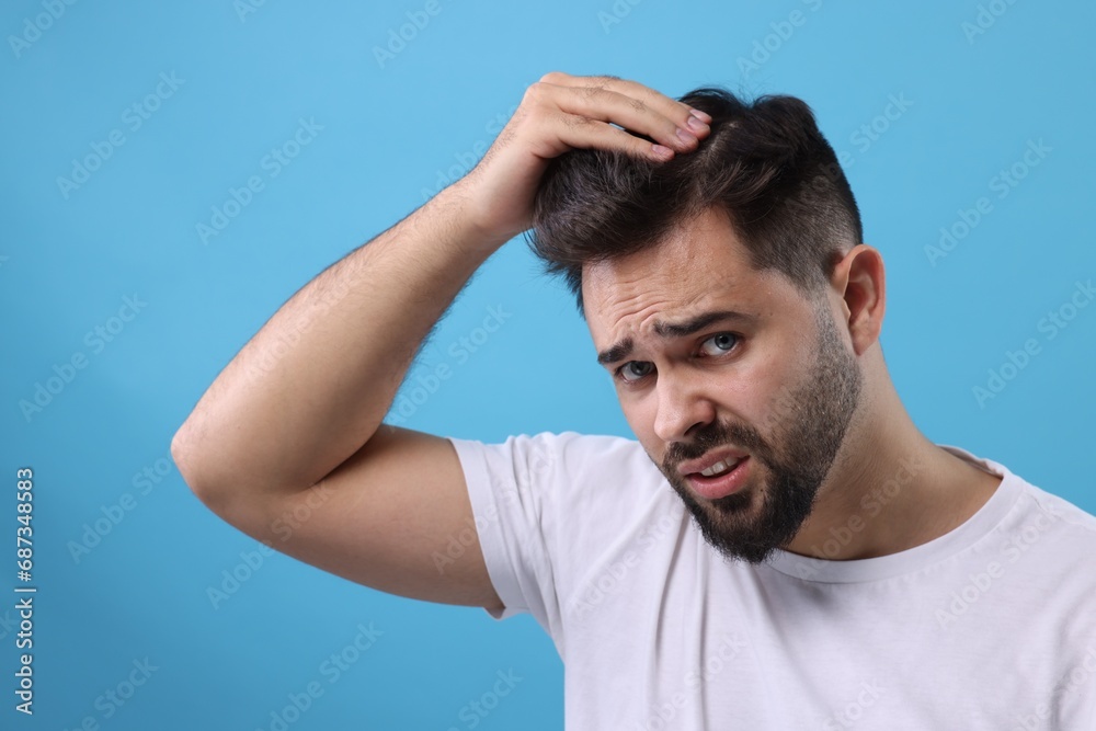 Emotional man examining his head on light blue background. Dandruff problem Emotional man examining his head on light blue background. Dandruff problem