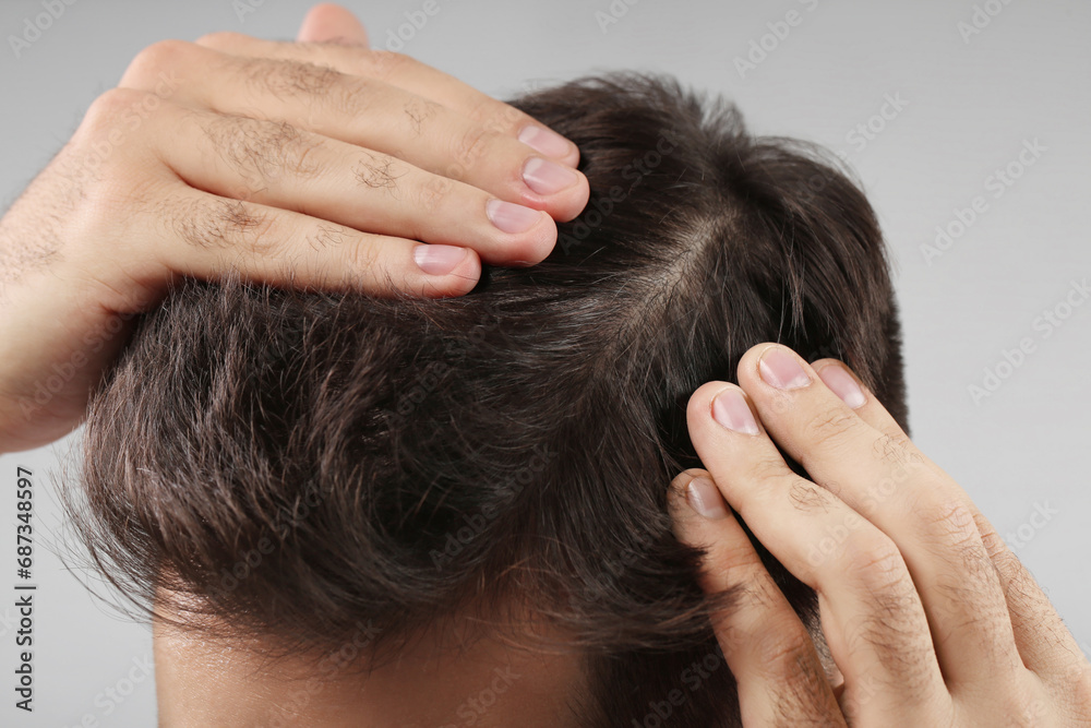 Fototapeta premium Man examining his head on light grey background, closeup. Dandruff problem