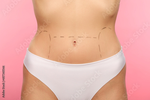 Slim woman with markings on belly before cosmetic surgery operation on pink background, closeup