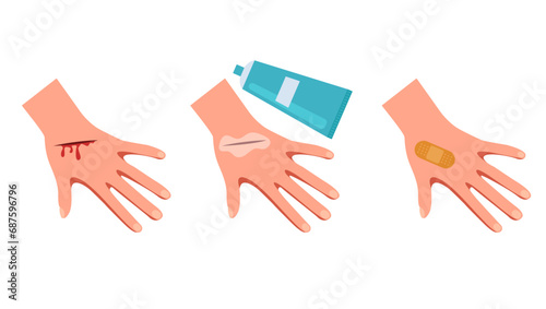 Hand arm with wound treating steps concept. Vector flat graphic design illustration photo