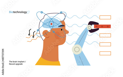 Bio Technology, Brain implant, Neural upgrade -modern flat vector concept illustration of brain implant, integration, enhanced cognitive abilities. Pushing boundaries of potential, neural upgrades