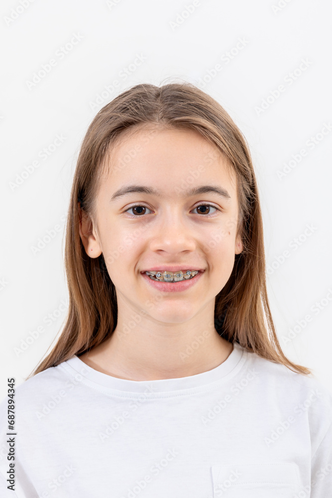 Brunette girl smiling with braces on her teeth on a white background isolated. Brunette girl smiling with braces on her teeth on a white background isolated.