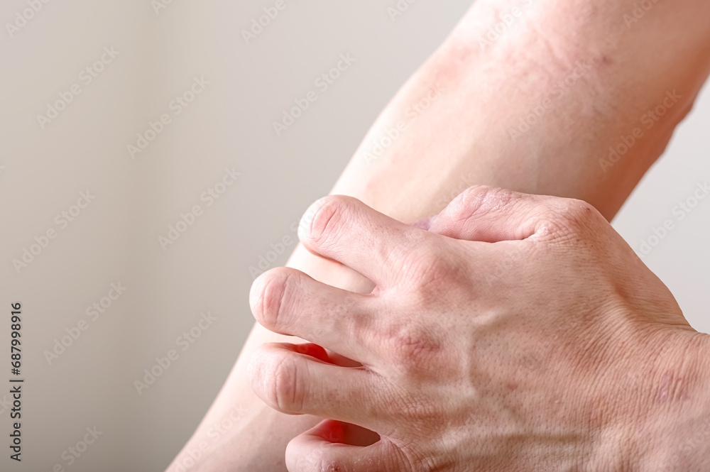 腕をかきむしる男性 腕をかきむしる男性