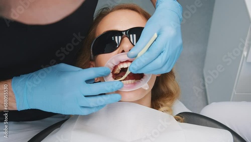 Professional caucasian dentist examines teeth of young female patient. Orthodontist installing dental retractor in mouth for teeth whitening. Treatment. Medicine. photo