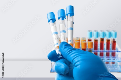 Hand of doctor holding tube test for medical analysis