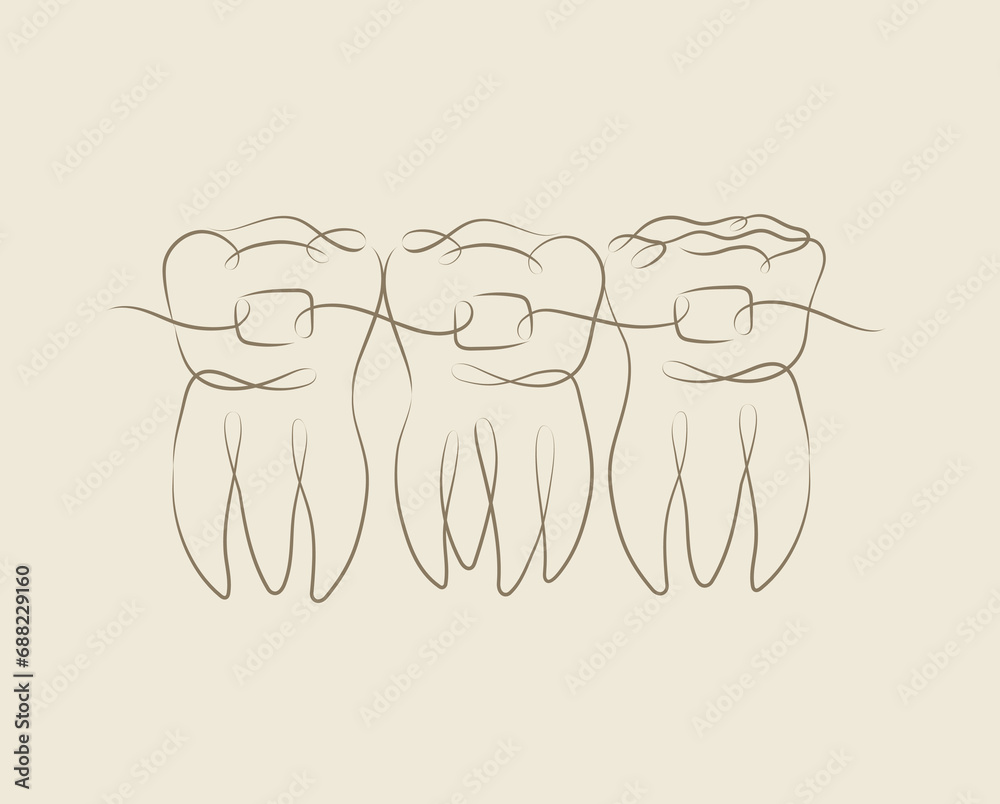 Teeth with braces illustration drawing in linear style on beige background