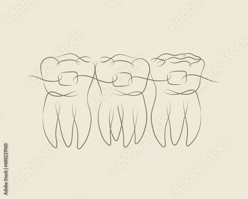 Obraz na płótnie Teeth with braces illustration drawing in linear style on beige background w salonie